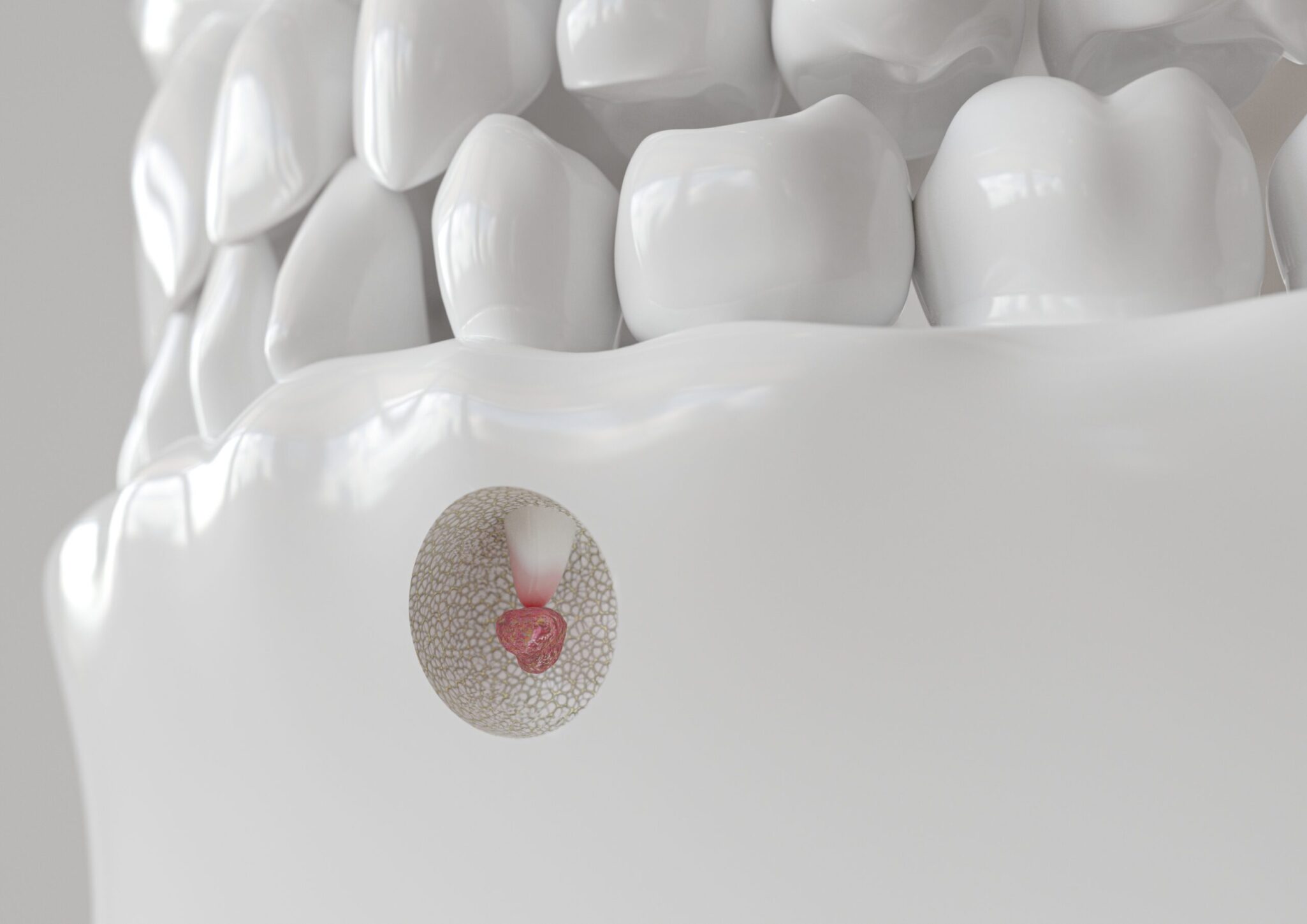 - Rocky Mountain Oral Surgery & Implant Center