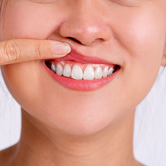 - Rocky Mountain Oral Surgery & Implant Center