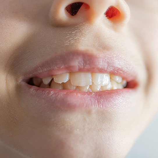 - Rocky Mountain Oral Surgery & Implant Center