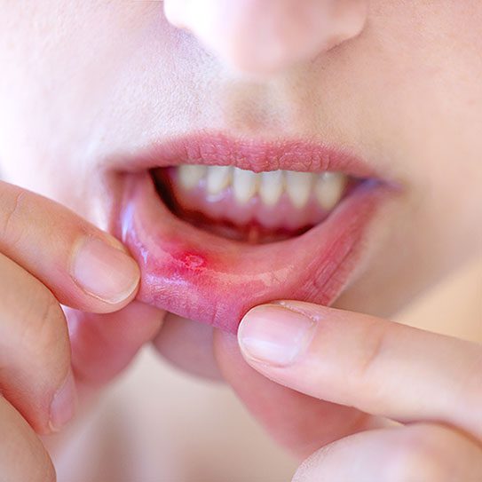 - Rocky Mountain Oral Surgery & Implant Center